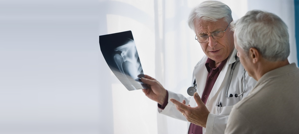 Patient und Arzt besprechen Röntgenbild Ein Patient und der Arzt besprechen im Stehen das Roentgenbild der Schulter